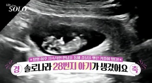 ENA, SBS Plus  SOLO