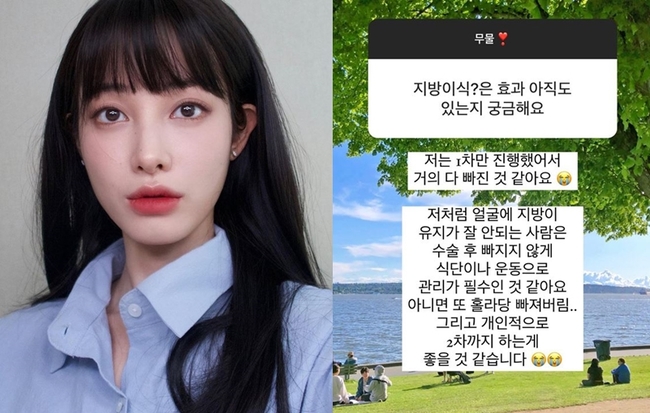 유깻잎, 얼굴 지방이식x가슴성형 공개→“얼굴은 관리 필수” 후기 - 손에 잡히는 뉴스 눈에 보이는 뉴스 - 뉴스엔