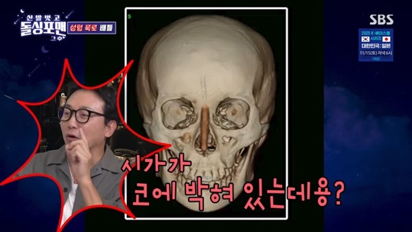 SBS ¡®µ¹½ÌÆ÷¸Ç¡¯