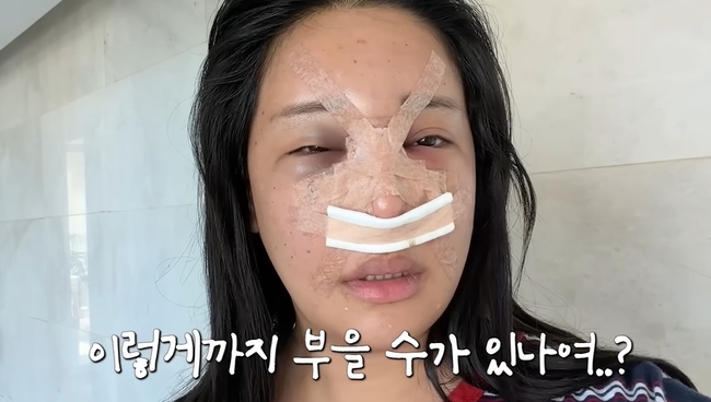 ���� ä�� ĸó