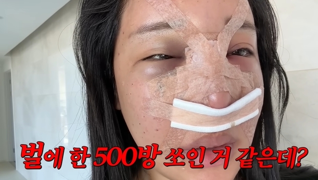 ���� ä�� ĸó