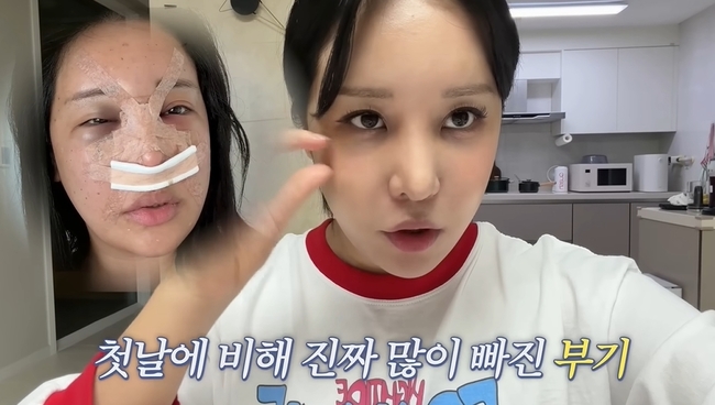 ���� ä�� ĸó