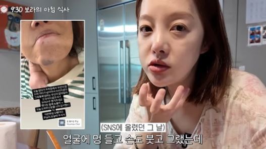 황보라 관련 보도 이미지