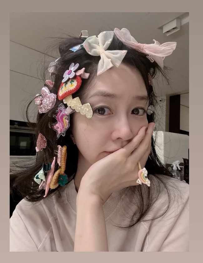 성유리 머리핀 근황 보도 이미지