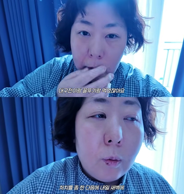신기루, 속초 이틀 먹부림 결과 스케줄 취소 병원行 “이러다 죽을 듯”(뭐든하기루) - 손에 잡히는 뉴스 눈에 보이는 뉴스 - 뉴스엔