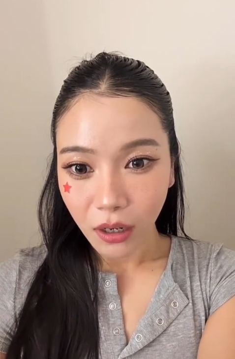 마마무 솔라, 미국 LA서 낯선 남성이 던진 의자에 맞아 부상