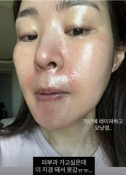 미자 소셜미디어